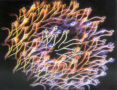 治疗少精症治疗方法有哪些呢？