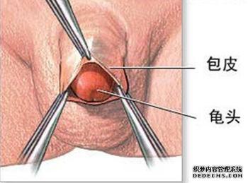 龟头炎的危害有哪些?